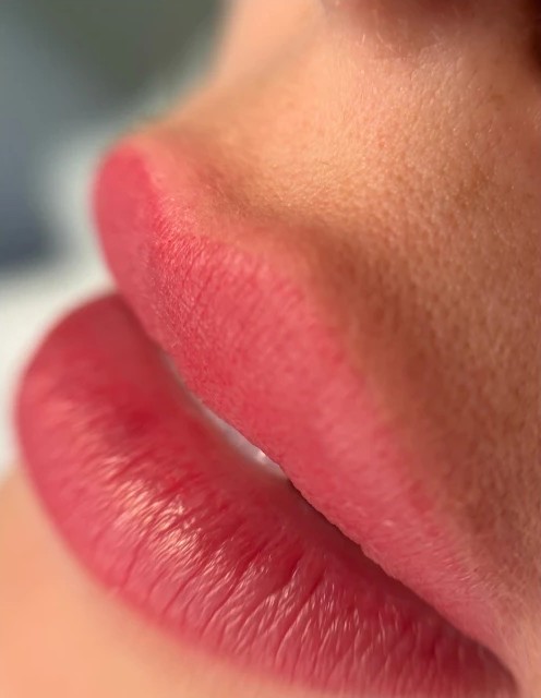 Balm Lips UP: depois
