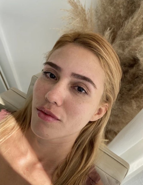 MB Brows: depois